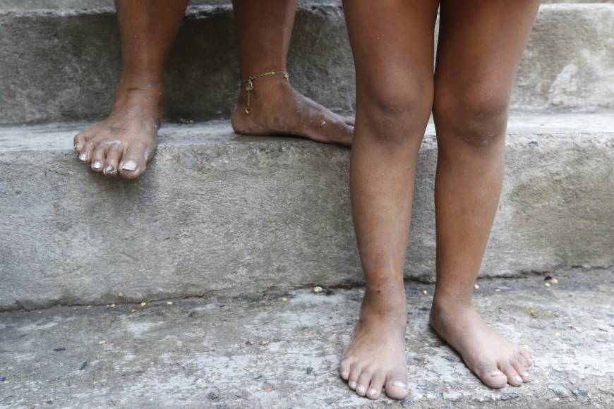 Tragedia: incendio dejó sin vivienda a 12 niños y a sus familias en la capital