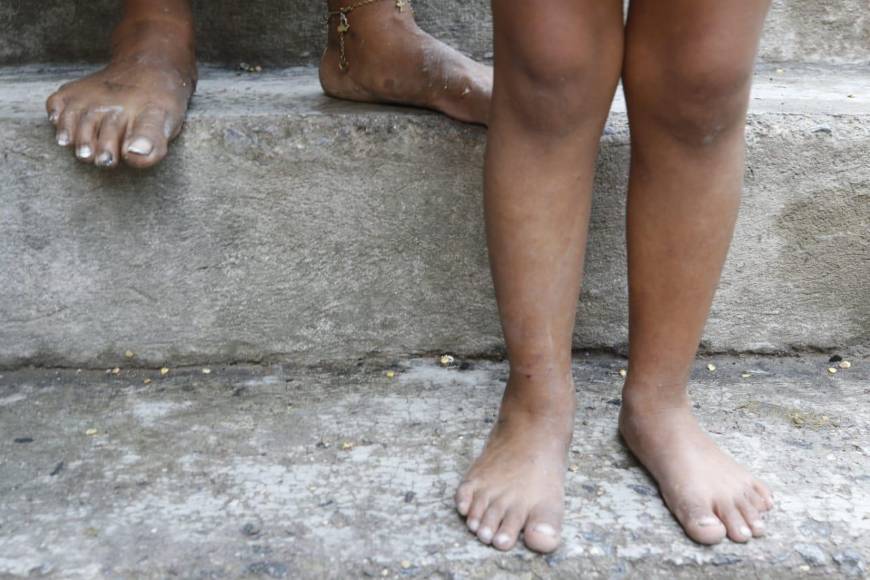 Tragedia: incendio dejó sin vivienda a 12 niños y a sus familias en la capital