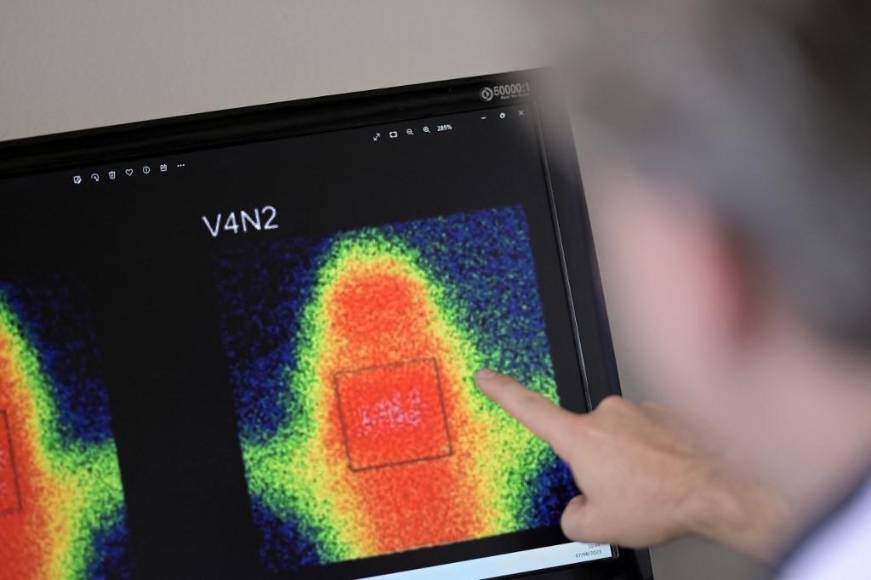 Calixcoca, la vacuna que busca inhibir efectos de la cocaína y crack