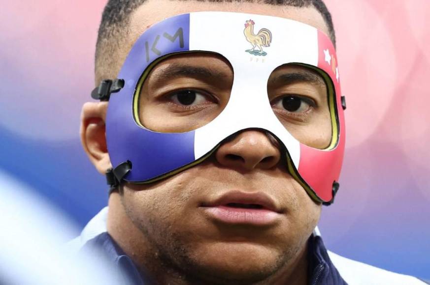 Eurocopa 2024: Kylian Mbappé usará una máscara especial tras la fractura en la nariz