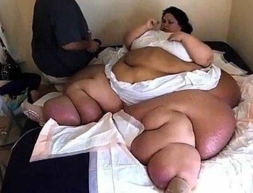 ¿Qué ha sido de Mayra Rosales, “la mujer más obesa del mundo”?