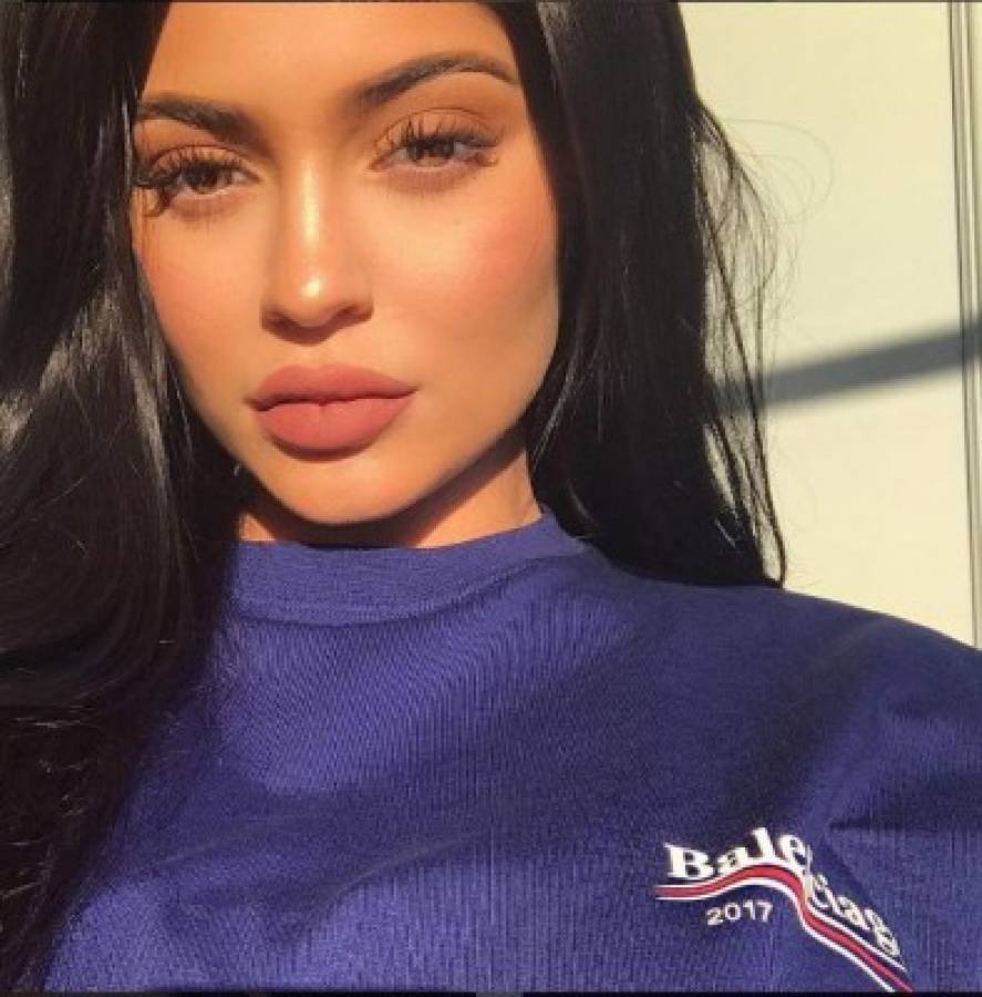 Kylie Jenner revela por qué se operó los labios