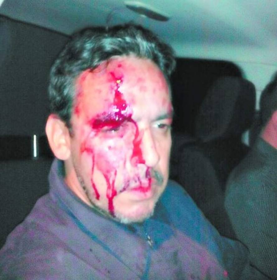 Indignados en huelga denuncian agresiones