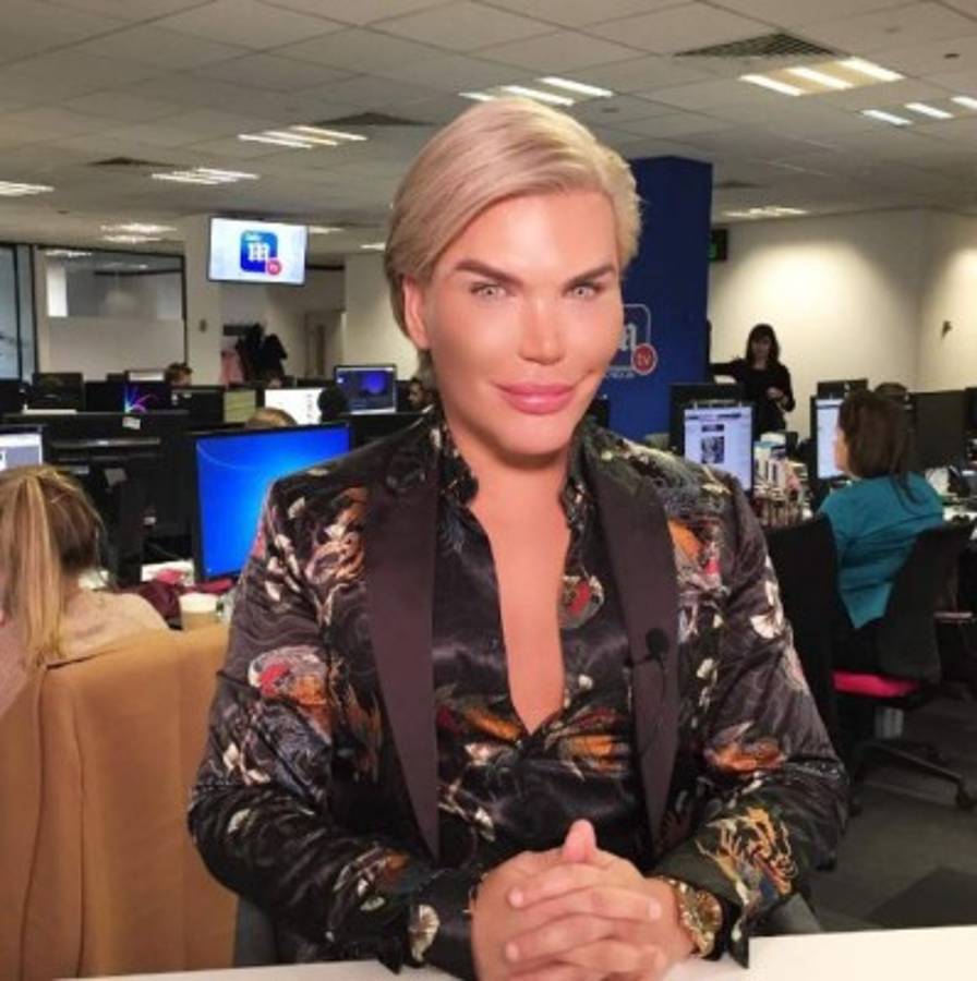 La controversial cirugía 190 del 'ken humano' brasileño ¿qué se hizo ahora?