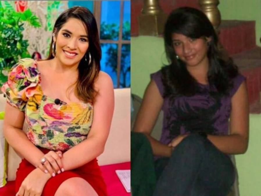 FOTOS: El antes y después de Carolina Lanza, polémica presentadora hondureña