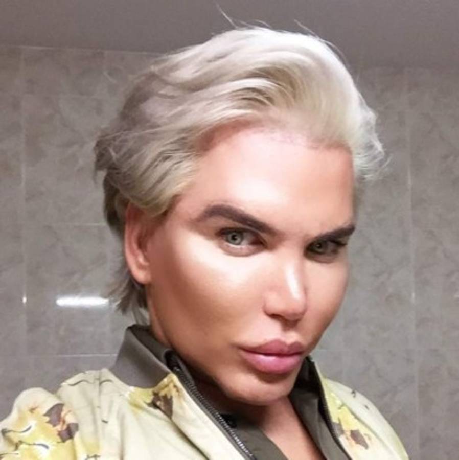 La controversial cirugía 190 del 'ken humano' brasileño ¿qué se hizo ahora?