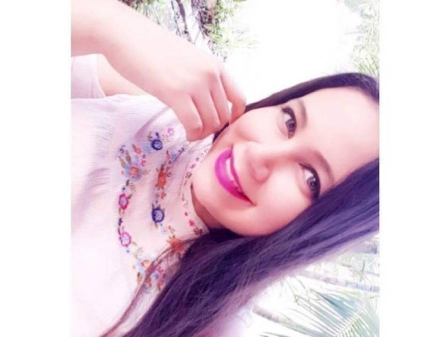 Celeste Gómez, la universitaria víctima del dengue grave en Honduras