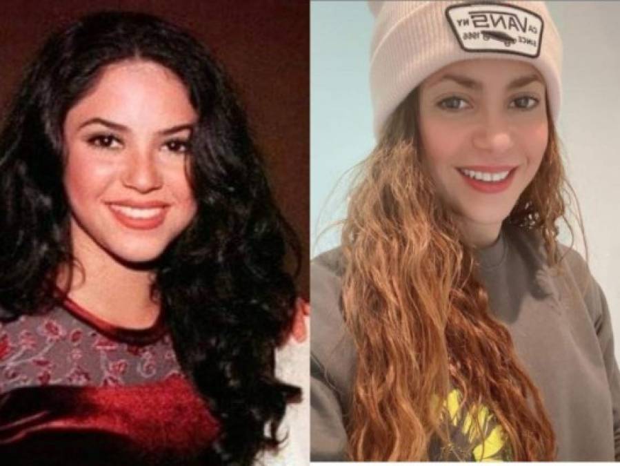 FOTOS: Antes y después de famosos que se operaron la nariz