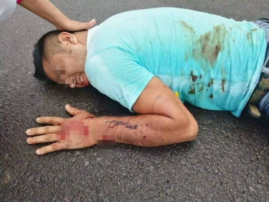 Las fuertes imágenes que dejó el accidente en carretera a Comayagua