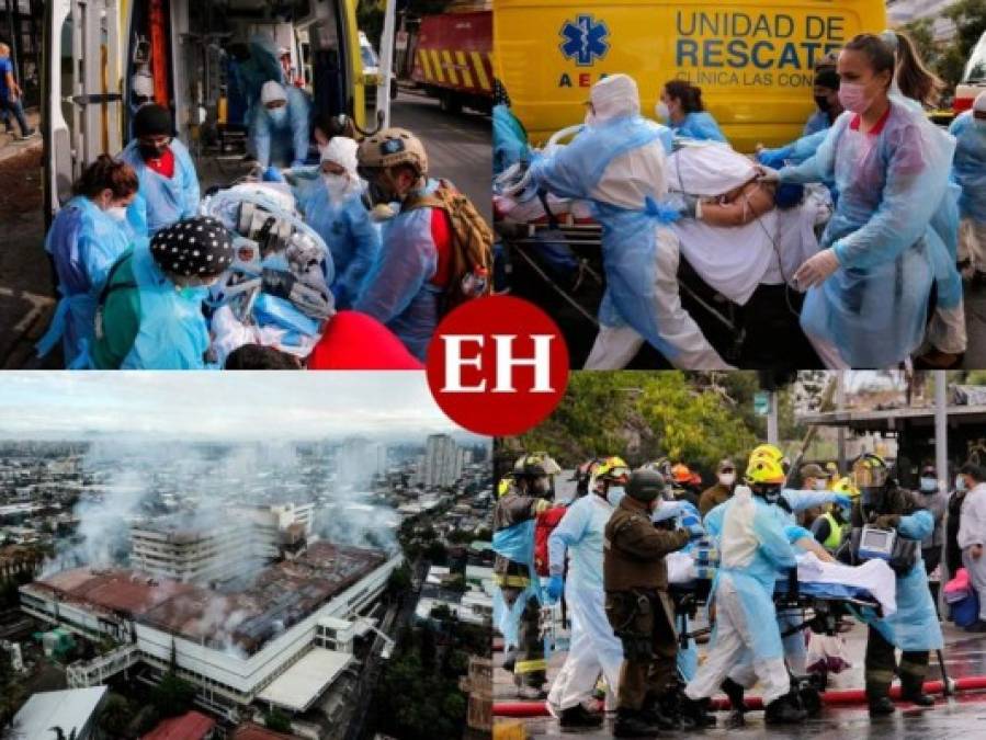 La dramática evacuación de pacientes entubados por incendio en hospital de Chile (Fotos)
