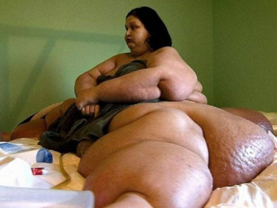 Impresionante transformación de la mexicana Mayra Rosales, la 'mujer más obesa del mundo'