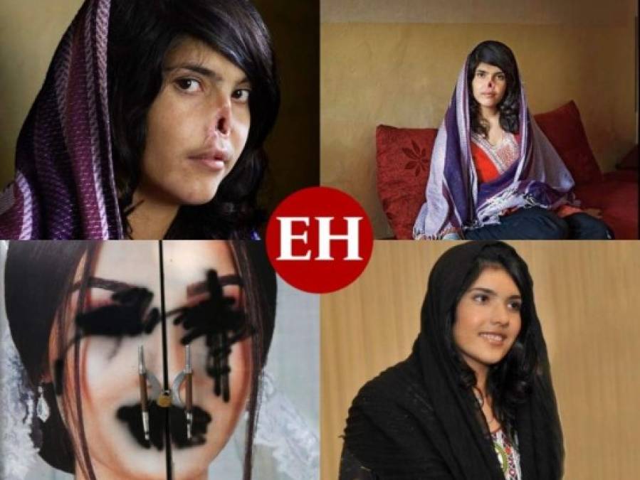 Aisha Mohammadzai, el rostro de la violencia de los talibanes contra las mujeres en Afganistán