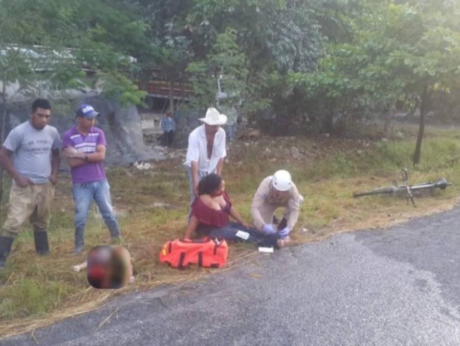 Las lamentables escenas tras accidente en carretera de Yoro