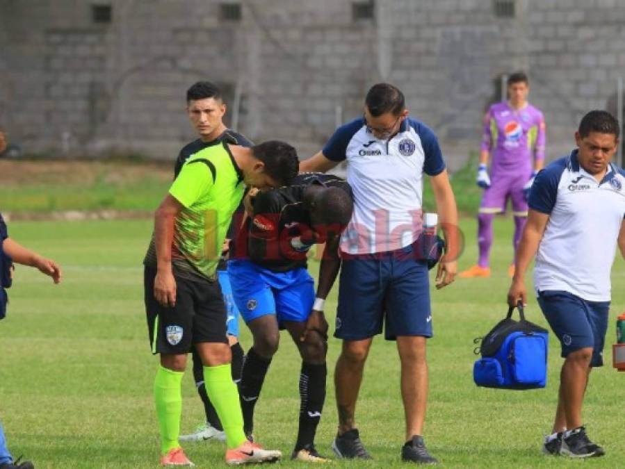 Las dramáticas lágrimas de Rubilio Castillo al salir lesionado del juego Real de Minas vs Motagua