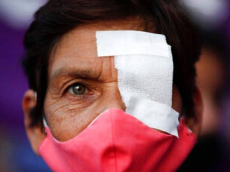 Pandemia, llanto y dolor en las fotos de la semana de América Latina