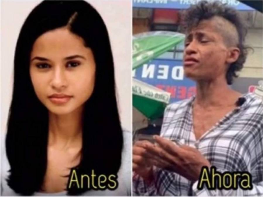 Antes y después de Suzy Pérez, modelo 'consumida' por las drogas