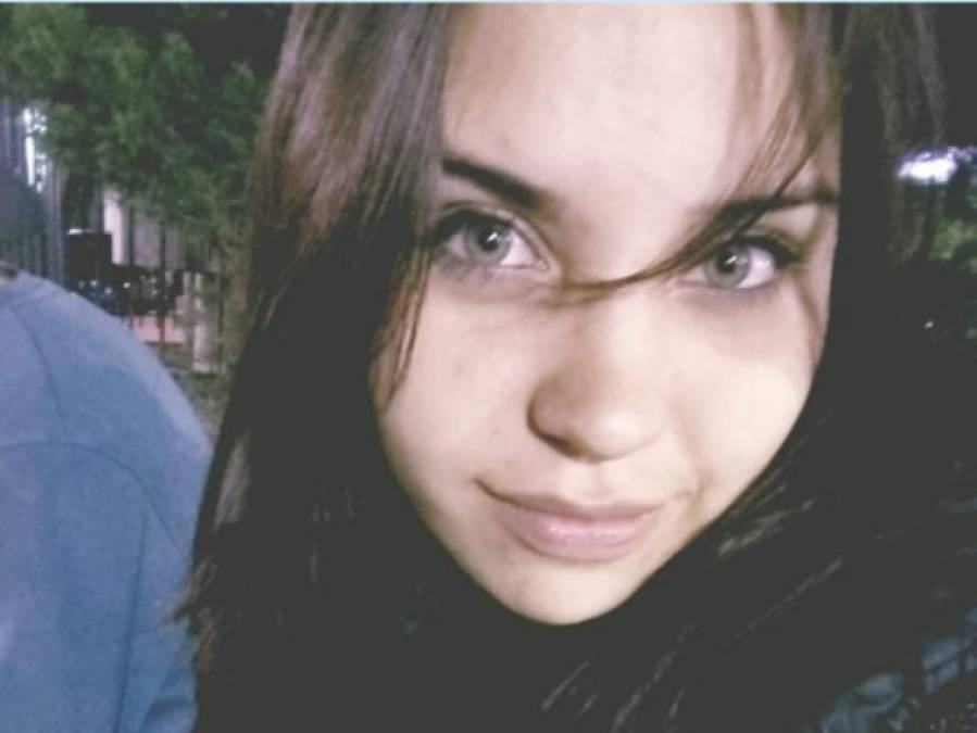 FOTOS: La historia de Micaela, la joven que fue quemada por su novio