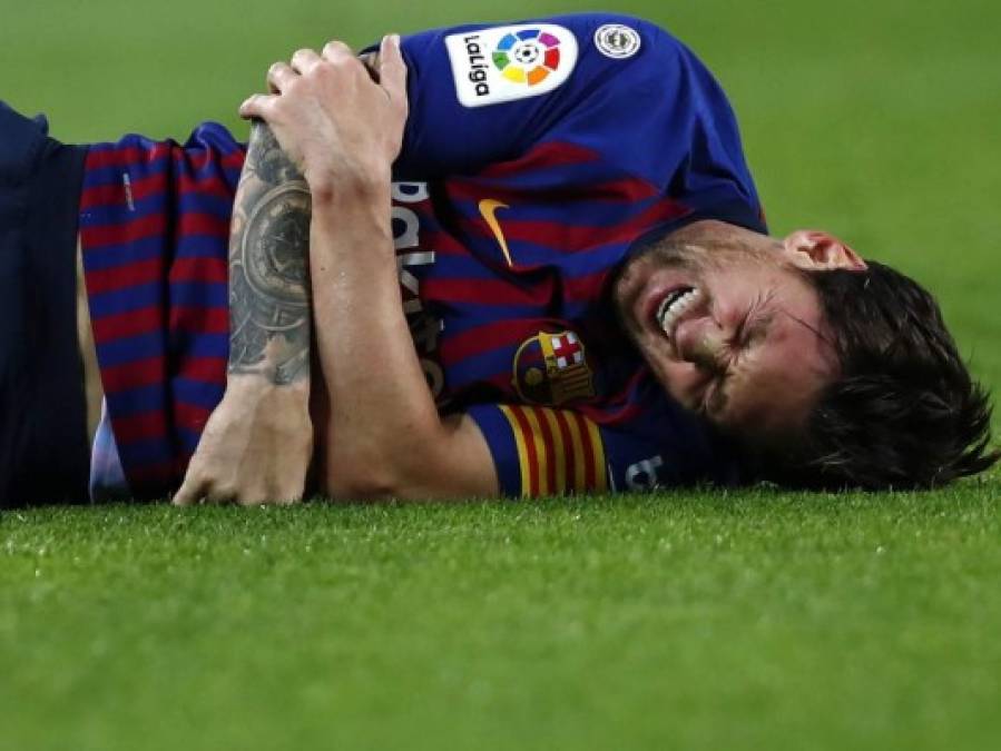 FOTOS: La dolorosa lesión que sufrió Messi en su brazo derecho