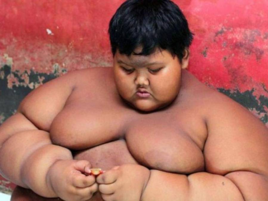 FOTOS: El cambio físico del niño más obeso del mundo que desea ser futbolista