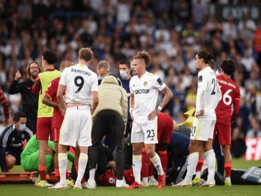 La espeluznante lesión de Harvey Elliott, mediocampista del Liverpool (Fotos)