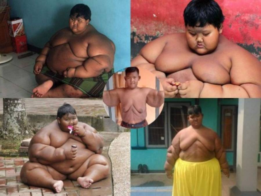 FOTOS: El cambio físico del niño más obeso del mundo que desea ser futbolista