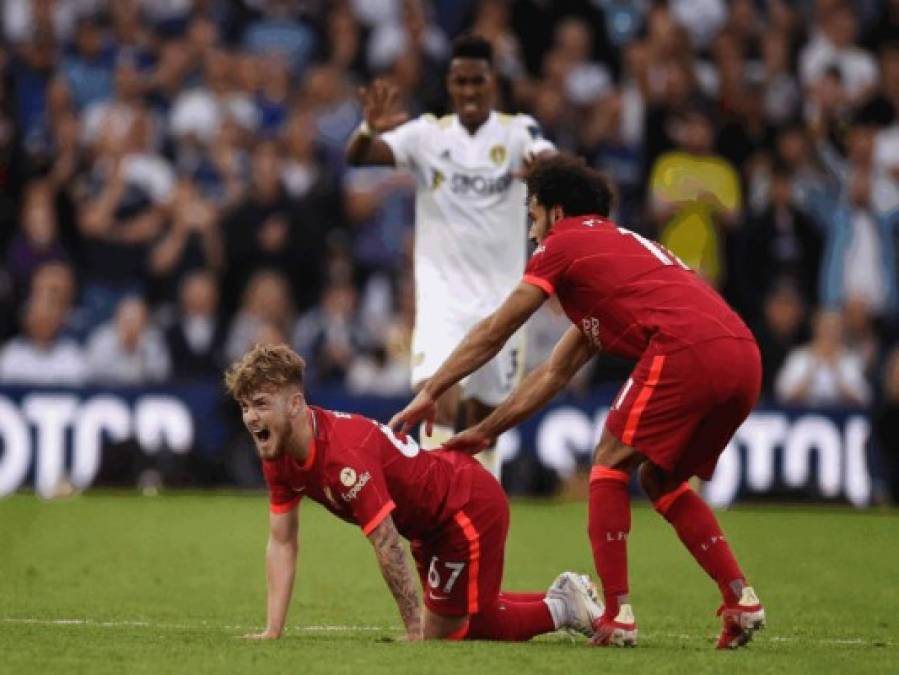 La espeluznante lesión de Harvey Elliott, mediocampista del Liverpool (Fotos)