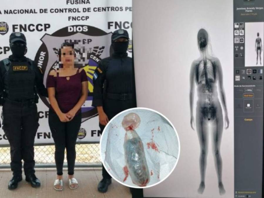 Vaginas, tortillas y churros: Inusuales métodos para intentar introducir droga en las cárceles de Honduras