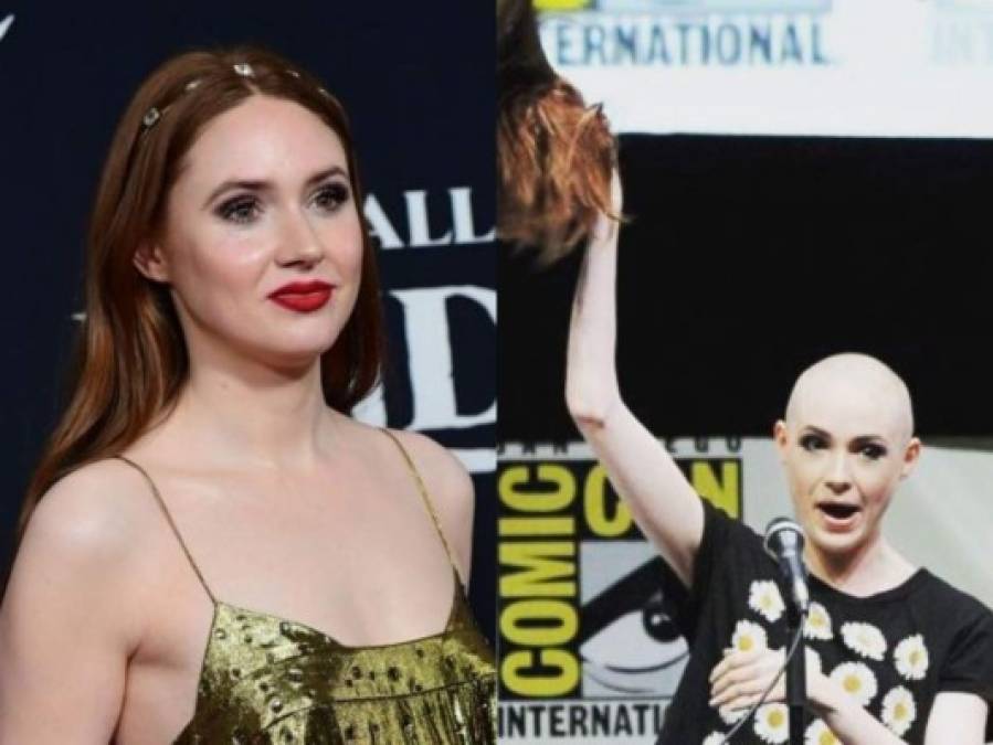 Antes y después: Famosas que se raparon el pelo y lucieron hermosas