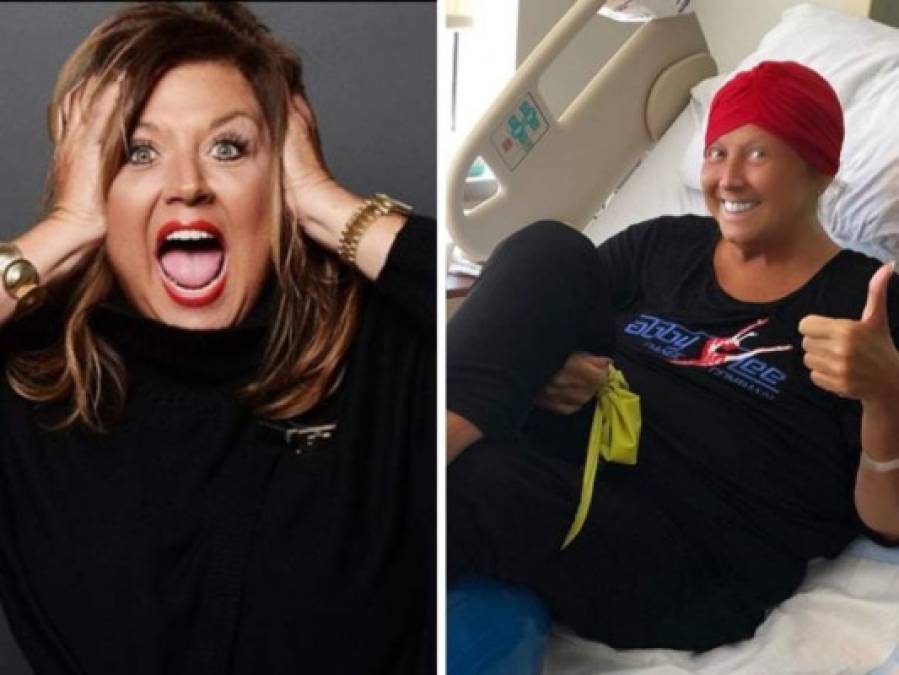 FOTOS: Los cambios físicos que sufrió Abby Lee Miller de 'Dance Moms' por su lucha contra el cáncer  