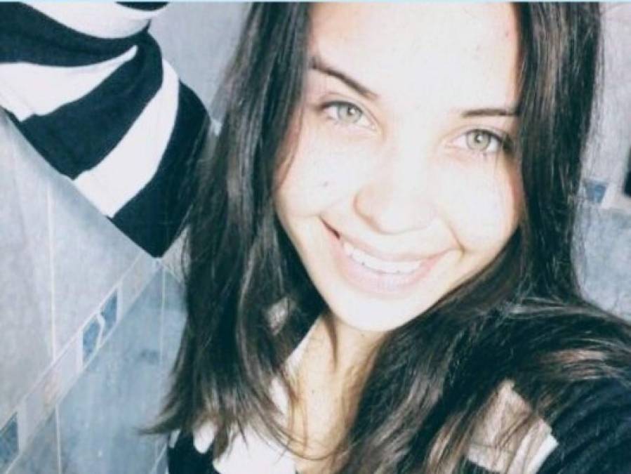 FOTOS: La historia de Micaela, la joven que fue quemada por su novio