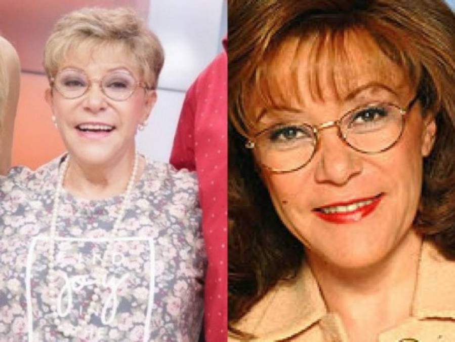 El antes y después del elenco de la telenovela Betty la Fea