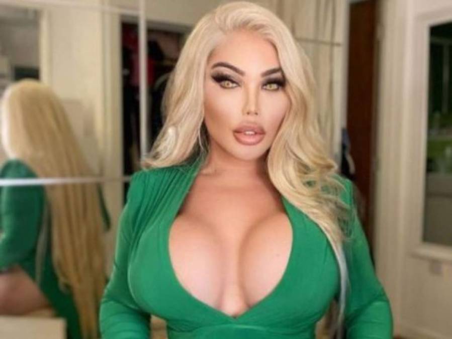 Jessica Alves, la mujer trans que quiere ponerse un útero para convertirse en madre