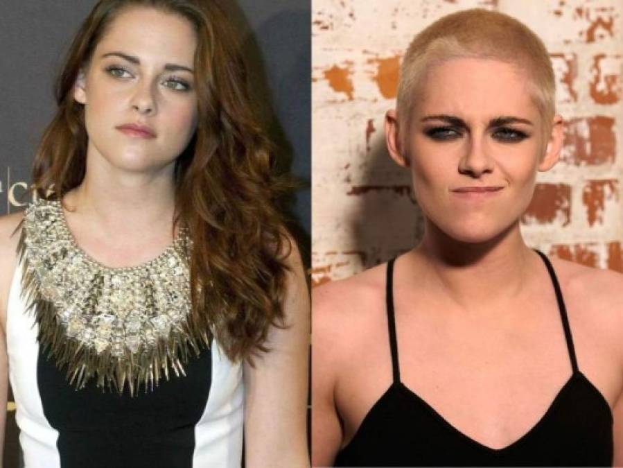 Antes y después: Famosas que se raparon el pelo y lucieron hermosas