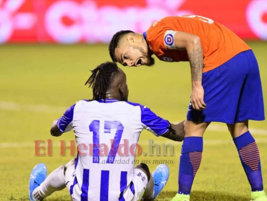 No se vio del Honduras vs Chile: el rugido de Elis, tristeza en Rueda y Coito celebra