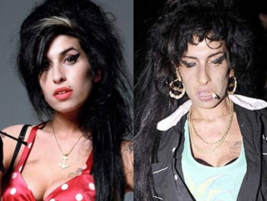 FOTOS: 13 famosos que quedaron desfigurados por las drogas