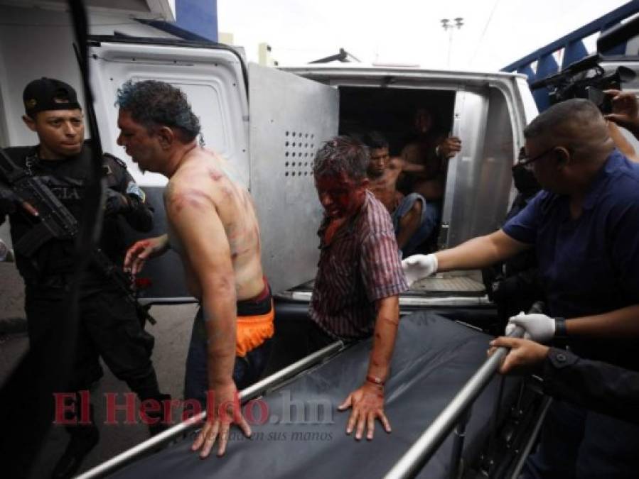 Las fuertes imágenes que dejó un enfrentamiento en la Penitenciaría Nacional de Támara