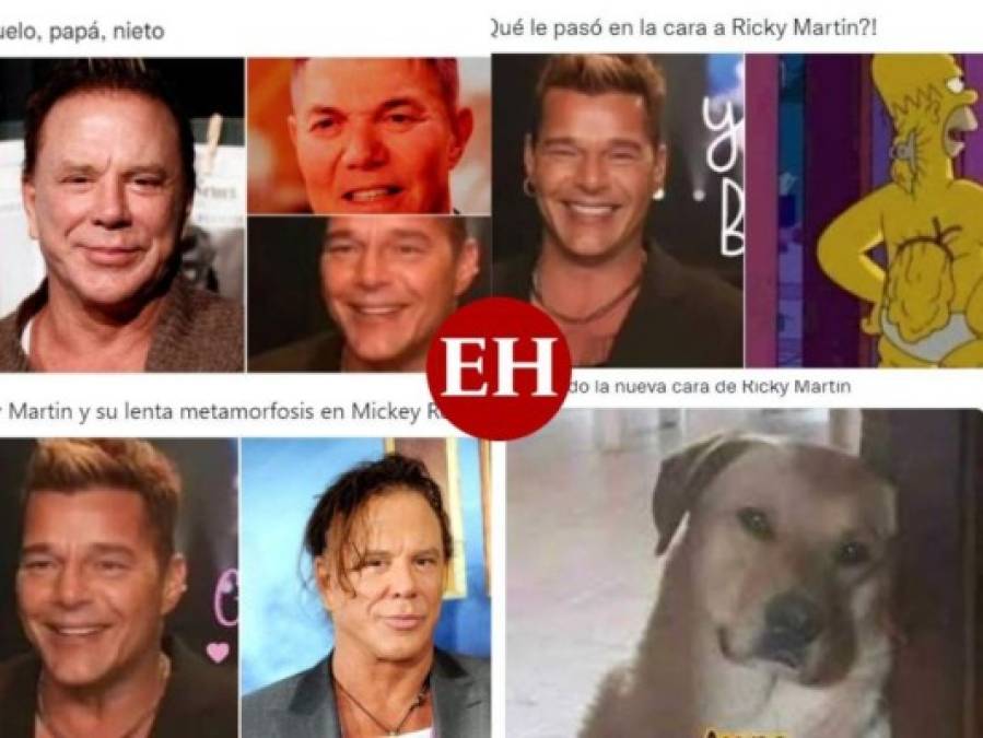 Ricky Martin se retoca la cara y desata una ola de memes