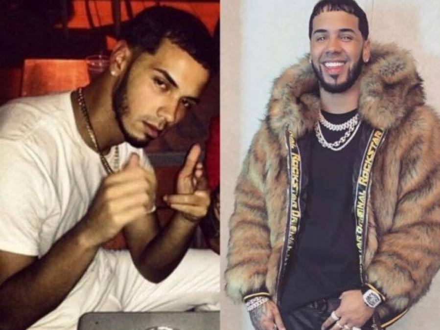 FOTOS: El antes y después del cantante de trap Anuel AA