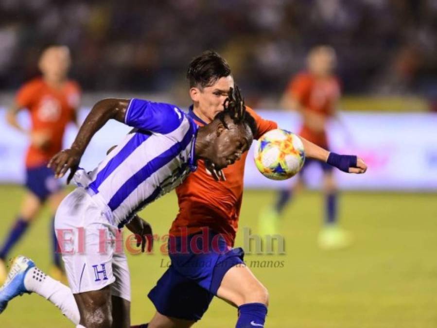 No se vio del Honduras vs Chile: el rugido de Elis, tristeza en Rueda y Coito celebra