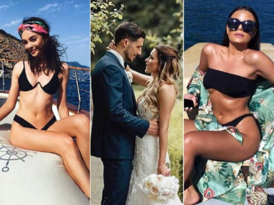 FOTOS: Las guapísimas novias y esposas de los jugadores de Australia