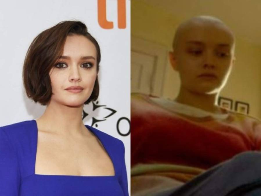 Antes y después: Famosas que se raparon el pelo y lucieron hermosas