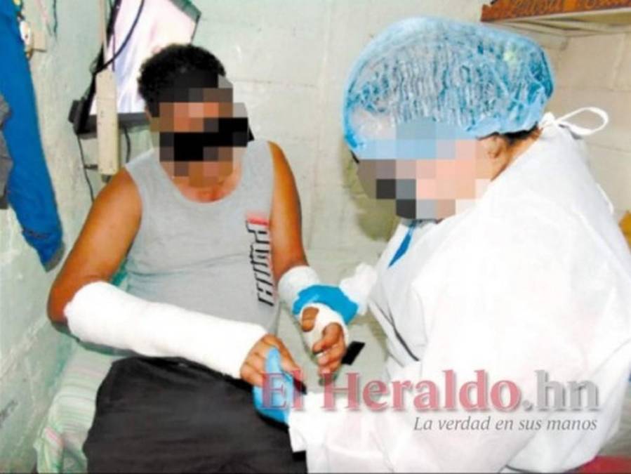 Infrahumana, insalubre y humillante: “La Bestia”, celda de abusos y torturas en Támara