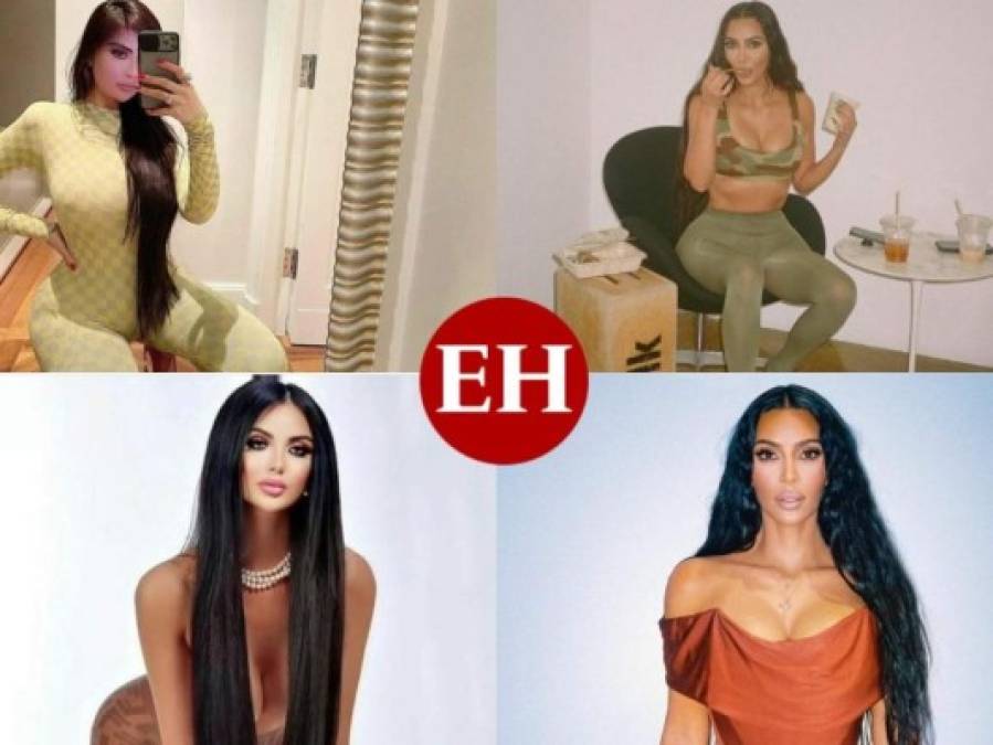 Influencer se realiza cientos de cirugías para parecerse a Kim Kardashian y ahora se arrepiente