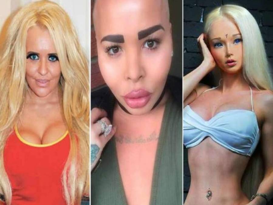 FOTOS: Locos fanáticos sometidos a cirugías para parecerse a famosos artistas