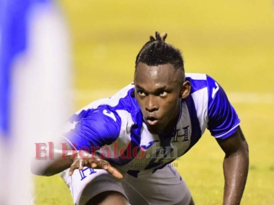 No se vio del Honduras vs Chile: el rugido de Elis, tristeza en Rueda y Coito celebra