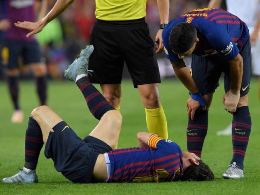 FOTOS: La dolorosa lesión que sufrió Messi en su brazo derecho