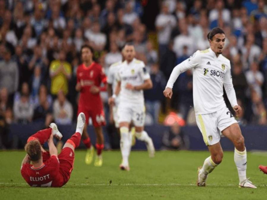 La espeluznante lesión de Harvey Elliott, mediocampista del Liverpool (Fotos)