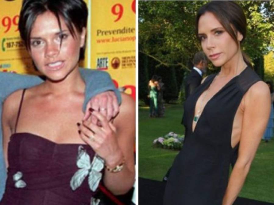 FOTOS: 10 famosas que transformaron sus cuerpos y rostros con cirugías