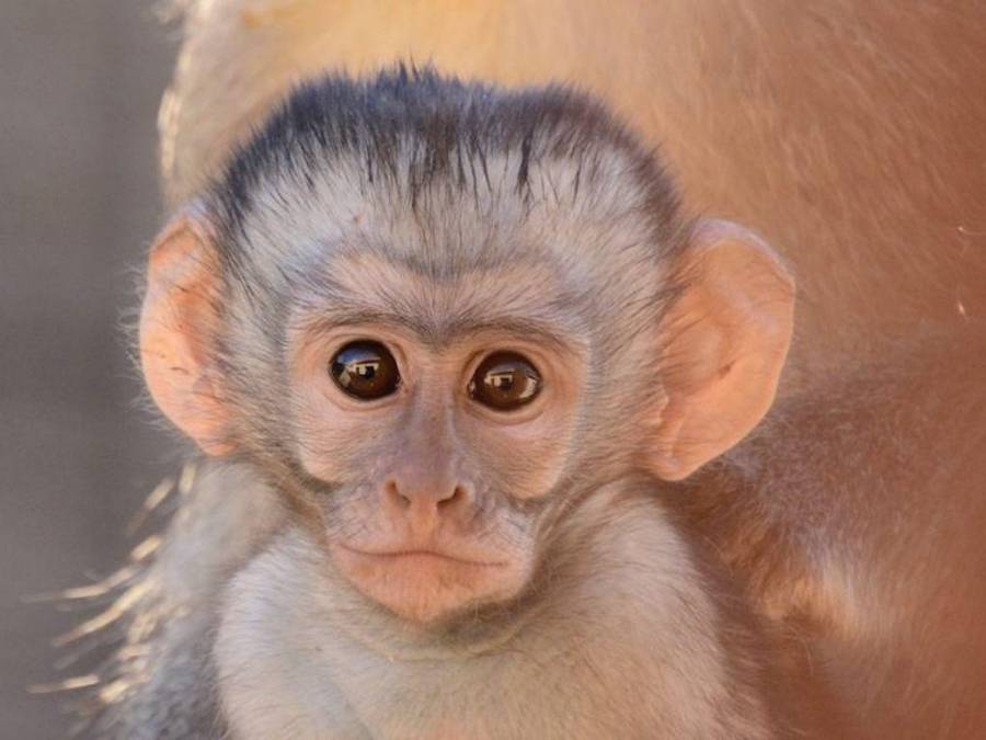 Viruela del mono, ¿qué es y cuáles son sus síntomas?