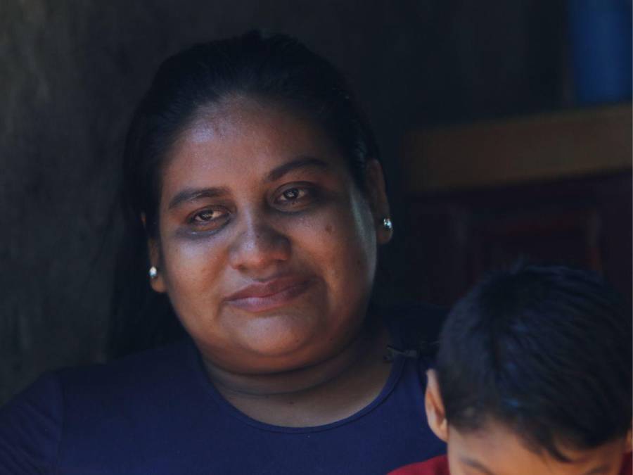 Un diagnóstico inesperado de microcefalia: “Mi sueño es verlo caminar” Un diagnóstico inesperado de microcefalia: “Mi sueño es verlo caminar”